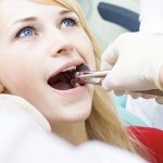 Что нельзя делать после удаления зуба? 